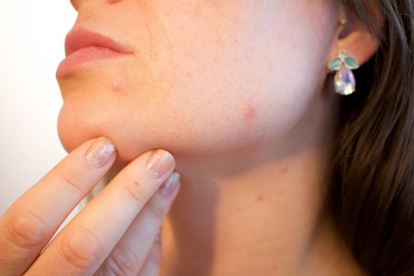 Curable Conditions Keeping Us From Looking Our Best