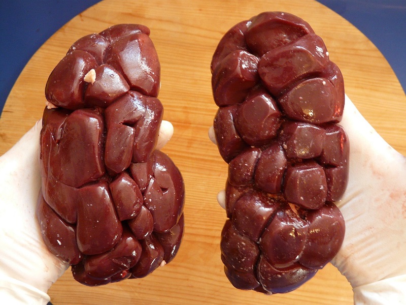 kidneys in 3D