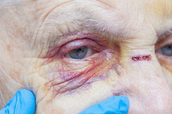 The Brutal Attack on a Defenseless Senior at a Detroit Nursing Home